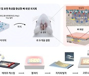 '새 뼈가 솔솔'…KAIST, 금 간 뼈 치료하는 반창고 신소재 개발