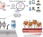 바이오 프린팅으로 위암 모델 제작…"맞춤형 치료법 개발 가능"