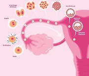 '재발률 80%" 난소암, 빠르고 정확히 진단하는 방법 개발