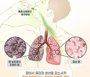 미국 이어 유럽서도 ‘희귀의약품’ 지정, 대웅제약 개발 중인 신약은?