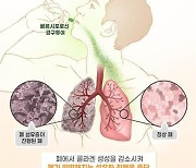 대웅제약, 폐섬유증 치료후보물질 유럽 '희귀의약품' 지정