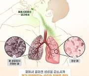 대웅제약 "특발성 폐섬유증 신약, 유럽서 희귀의약품 지정"