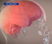 ‘뇌 안의 칩’으로 전자기기와 소통될까