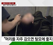 탈모인, 머리 매일 감는 게 좋을까? 피부과 교수가 답한 탈모 5계명