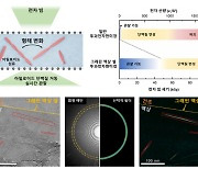 알츠하이머 발병 수수께끼 푼다…유발 단백질 실시간 관찰