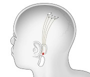 머스크, 사람 뇌에 무선칩 이식 “휴대전화 제어할 것”