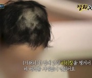 애인 감금·성폭행 '바리캉男' …억대 기습공탁에도 징역 7년