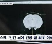 머스크 "인간 뇌에 인공 칩 최초 이식"…"생각만으로도 기기 제어 가능"