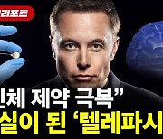 머스크 "신체 제약 극복이 시작"..뇌-컴퓨터 연결 기술 가속화 [디지털리포트]