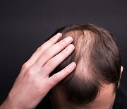 Alopecia expert recommends washing hair less to lose less