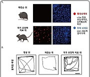 IBS '자기장' 이용해 무선으로 파킨슨병 치료한다