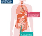 가슴 불편하고 뻐근...체한 줄 알았더니 심근경색 신호였다 [건강한 가족]