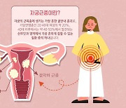 [주말 PICK!] 20대 자궁근종 증가…의심해야 할 5가지 증상은