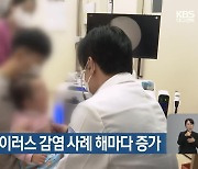 대구 노로바이러스 감염 사례 해마다 증가