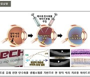 실명 유발 '망막 박리' 해조류로 치료…인공 유리체 소재 개발