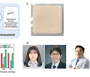 머리 수술때 접착제 뿌리고 빛 쪼이면 5초만에 봉합