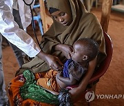 SOMALIA PHOTO SET MALNUTRITION