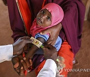 SOMALIA PHOTO SET MALNUTRITION