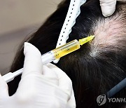 성남시의회, '탈모 청년 치료비 지원' 조례 추진