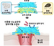 홍합과 누에고치로 장기 출혈 막는다…새로운 지혈제 개발