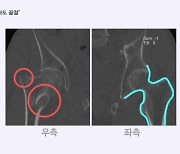 [단독] "엑스레이만 봐도 골절인데"…경찰, 부실 수사 논란