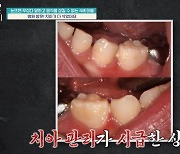 오은영 “침 삼키는 것부터!” 치아 삭을 정도로 음식 물고만 있는 ‘금쪽’ 분석[결정적장면]