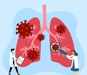 ‘5년 생존율 38.5%’ 폐암, 어떻게 예방할까?