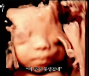 '임신' 황보라, 입체 초음파로 2세 외모 걱정 "오덕이 코 못생겨"