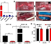 꿰매지 않아도 1분 만에 신경봉합…패치형 신소재 개발