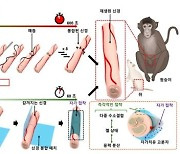 "절단된 신경 붙이는 밴드" 성균관대 연구팀 개발