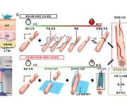 절단된 신경 '꿰맬 필요 없이 밴드로 감아서' 1분 안에 치료