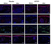 민감성 피부 개선 '투과성 펩타이드' 개발…효능 규명