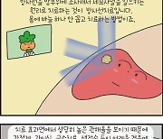 [만화 그리는 의사들]〈311〉간암의 치료-방사선 치료