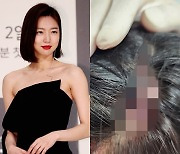 하연주, 드라마 촬영 중 머리 찢어져.. “손+물건으로 맞아”