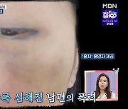 ‘고딩엄빠4’ 고현정, 전남편 폭력·외도로 이혼 “두 딸과 4년 동안 못 만나” 눈물