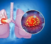 "금연보다 확실한 폐암 백신 나올까?"...英서 백신 개발 추진
