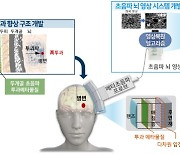 메타물질 기반 뇌융합기술 개발 본격화