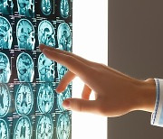 ‘뇌종양’ 재발 일으키는 원인 ‘세계 최초’ 발견…치료 실마리 찾아
