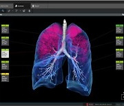 코어라인소프트, 유럽 주요 병원에 AI 설루션 공급