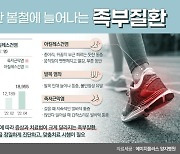 따뜻한 봄날, 외출인구 늘면서 족부질환자도 증가