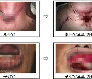 '구강암으로 가는 길'…담뱃갑 경고 그림·문구 더 살벌해진다