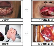 담뱃갑 경고 그림 연말에는 더 빨갛게, 더 끔찍하게