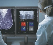 LG launches medical display monitor for accurate breast cancer screening