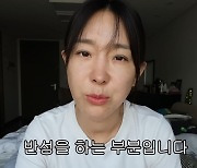 이지혜 "어릴 때 성형, 지금은 NO..자연스럽지 않아" 쿨한 고백