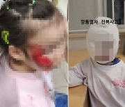 ‘깡통열차’ 뒤집혀 끔찍 사고…“3살 딸 얼굴 갈렸다”