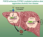 전남대 최흥식 교수 연구팀, 알코올성 간 손상 핵심인자 규명