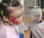 "3살 딸 얼굴 갈렸는데 테마파크는 나 몰라라"...포천 테마파크서 '깡통열차' 전복 사고