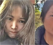 예뻤던 얼굴 어디로···3개월 만에 '폭삭' 늙은 20대女, 너무 걸어서?