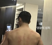 "충성!" 방탄소년단 뷔, 영광의 상처·눈부신 몸매..군복무 근황 공개