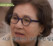 오미연 "교통사고로 코 잘리고 얼굴 날아가... 7시간 수술"